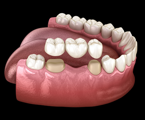 Treatment - smilemakerdentalcare