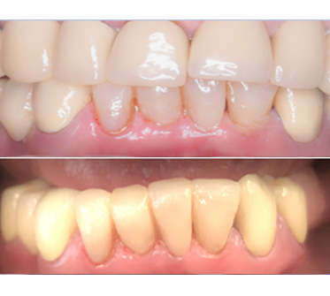 After - rosewood-dental